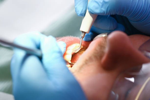 Best Pediatric Emergency Dentist in Buffalo, TX