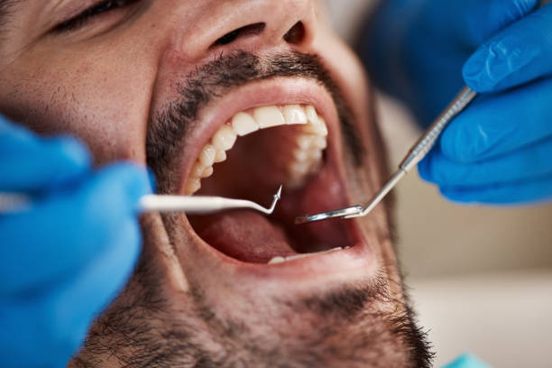 Best Emergency Dental Care for Trauma or Injury in Buffalo, TX