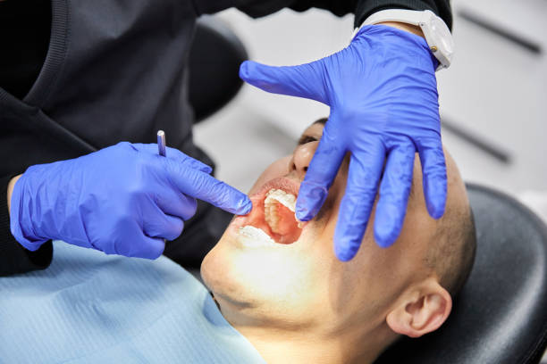 Best Emergency Tooth Extraction in Buffalo, TX