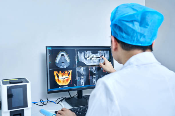 Best Emergency Tooth Extraction in Buffalo, TX