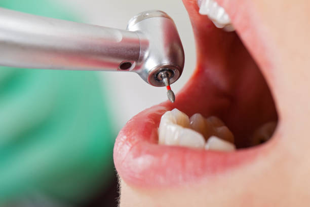 Best Emergency Dental Care for Trauma or Injury in Buffalo, TX
